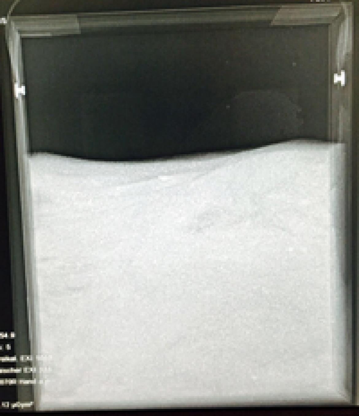 Luftpackung: Röntgenaufnahme eines Waschmittels
