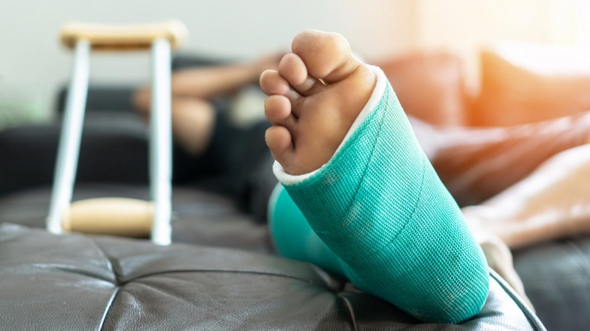 Fuß im Gipsverband